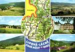 Lipová- Lázně