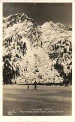 Popradské pleso, Kopky, Vysoká